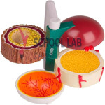 Diabetes Model: 4-Piece